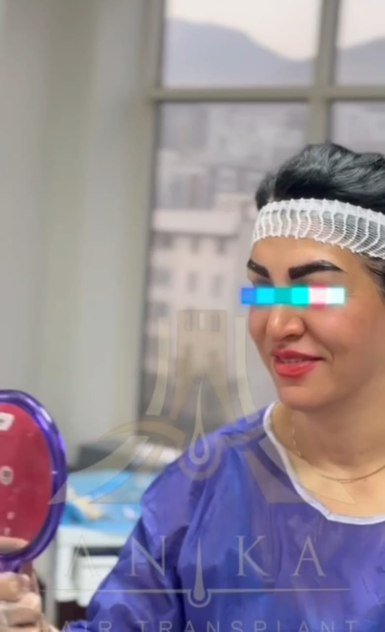 ابروهای زیبا جاشون روی پیشانی شماست!!!